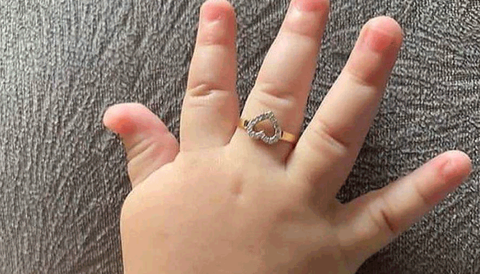طلا برای نوزاد (انگشتر)